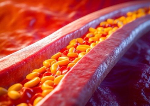 Dicas para controlar o colesterol com alimentação e exercícios